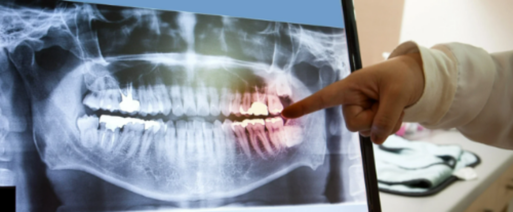 Gum Protect - Herstellende Tandpasta