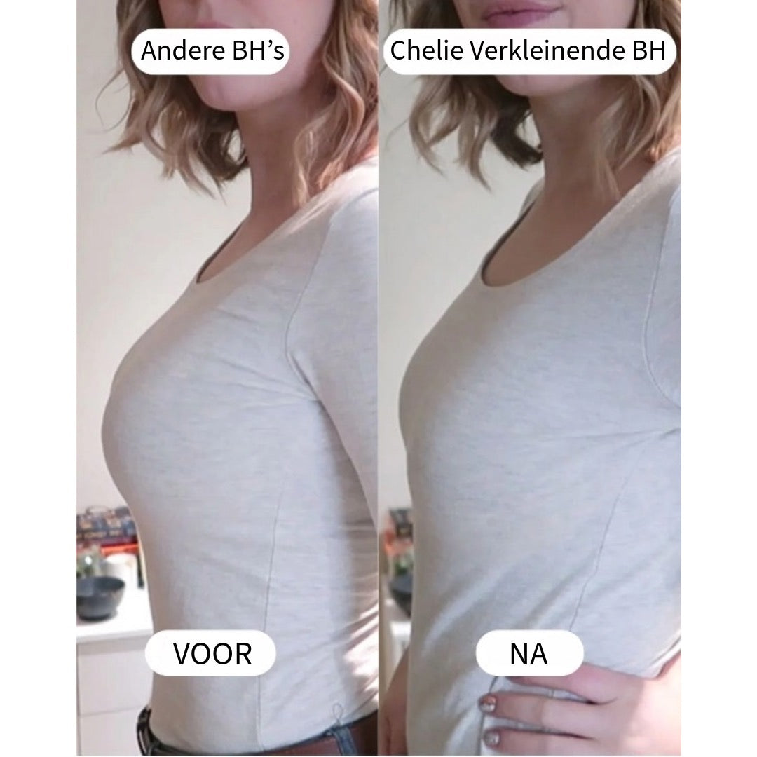 Borstverkleinende BH