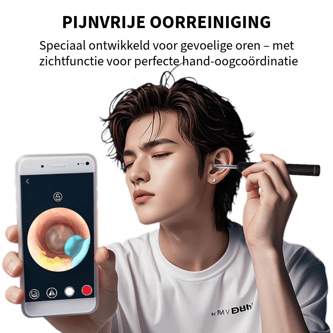 Professionele Oorsmeerverwijderaar met Camera