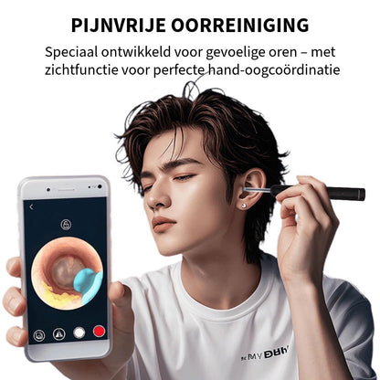 Professionele Oorsmeerverwijderaar met Camera