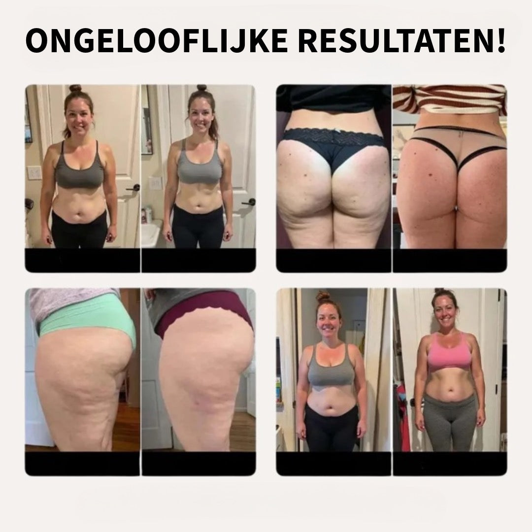 Anti-Cellulitis Legging