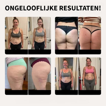Anti-Cellulitis Legging