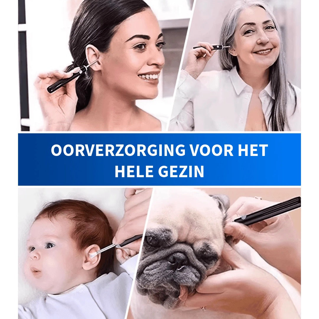 Professionele Oorsmeerverwijderaar met Camera