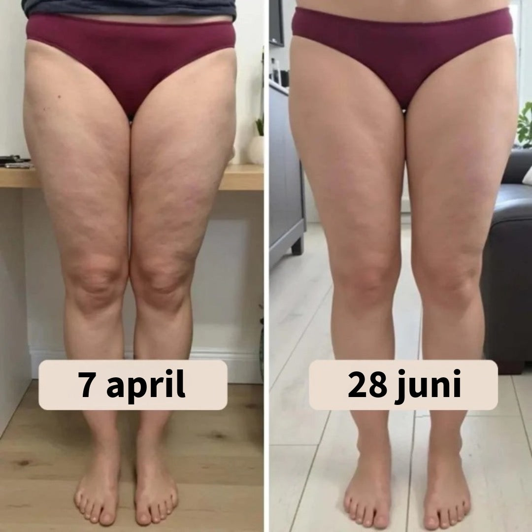 Anti-Cellulitis Legging